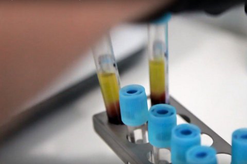 Біотехнології як шанс для української економіки
                        Актуально