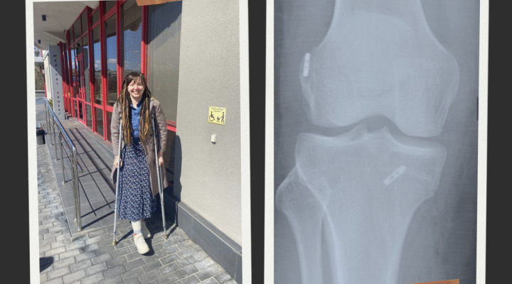 На чотирьох ортопедів — три різні думки. Історія однієї травми коліна, яка насправді про всіх нас