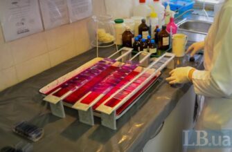 Бацили Коха можуть бути спокійні