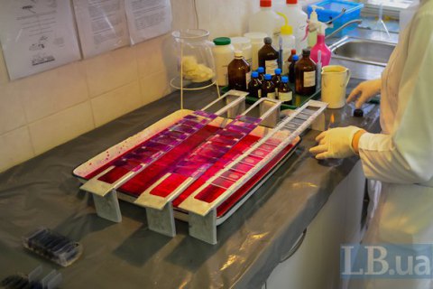 Бацили Коха можуть бути спокійні