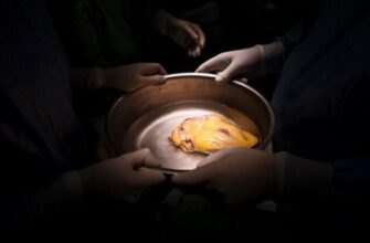 Від серця до серця: що відбувається з пересадками органів в Україні