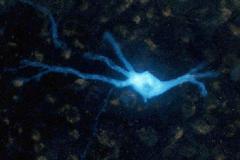 Любовь вместо анальгина