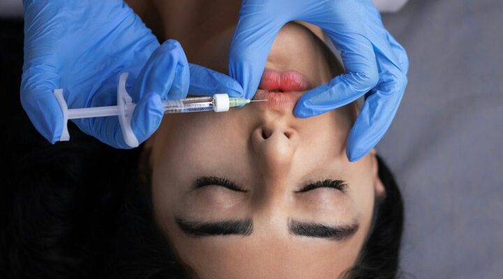 Тренд на природність: чому жінки почали зменшувати собі губи і груди до «рідних» розмірів