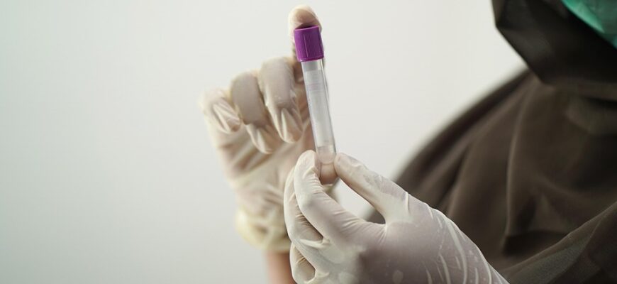 проба шиллера позитивна що означає