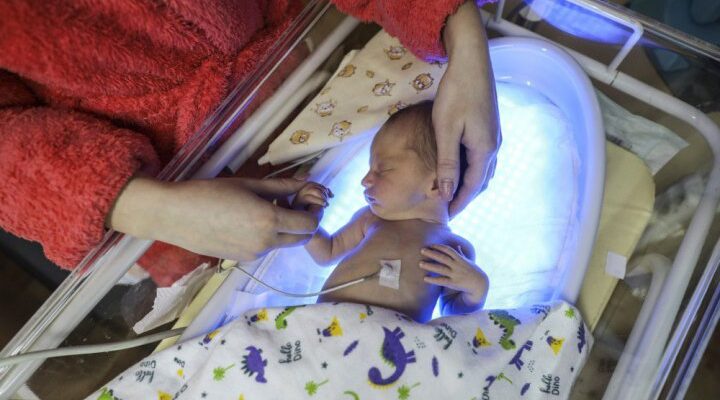 Передчасно народжені діти: як працює Програма медичних гарантій