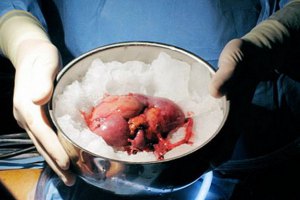 Кто на органы пойдет?