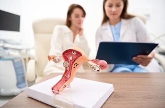 Синдром поликистозных яичников